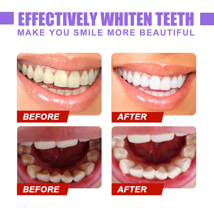 HiSmile V34 Teeth Whitening Purple Toothpaste